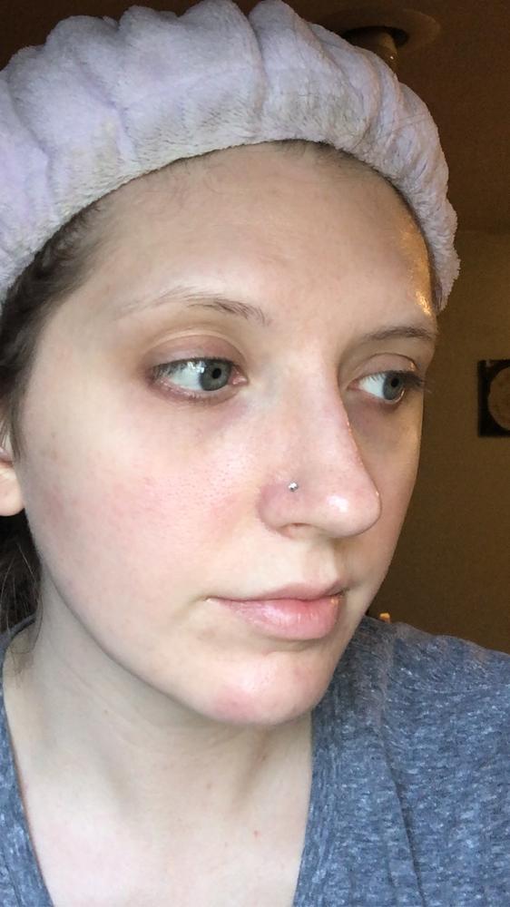 Bright Eyes Masks - Customer Photo From Brittany