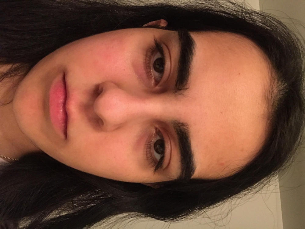 Vitamin C Serum - Customer Photo From Mahsa Koushkebaghi